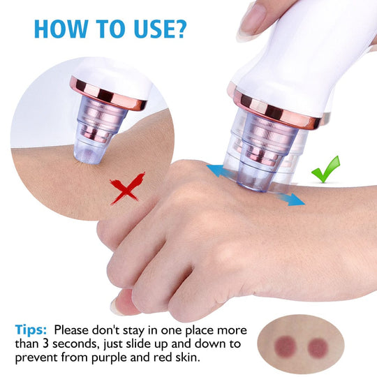 Heidi-Mode | Blackhead Instrument Elektrisch Saugwerkzeug Gesicht Wasch Instrument Schönheit Akne Reinigung Blackhead Saugwerkzeug